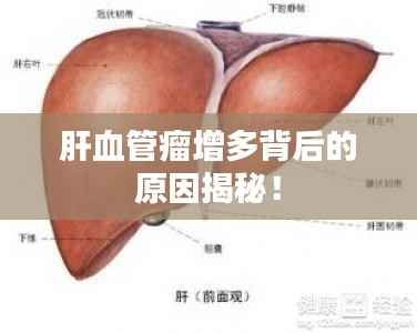 肝血管瘤增多背后的原因揭秘!