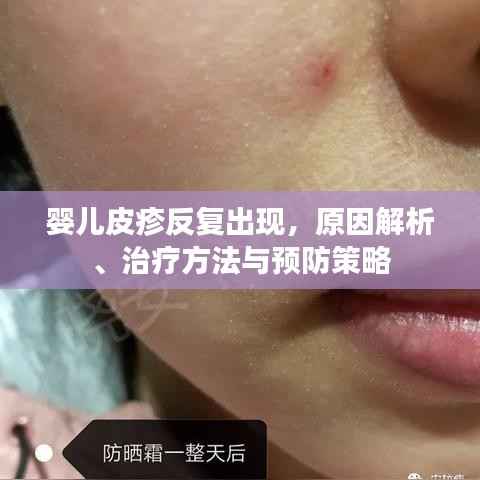 婴儿皮疹反复出现,原因解析、治疗方法与预防策略