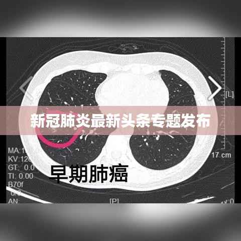 新冠肺炎最新头条专题发布